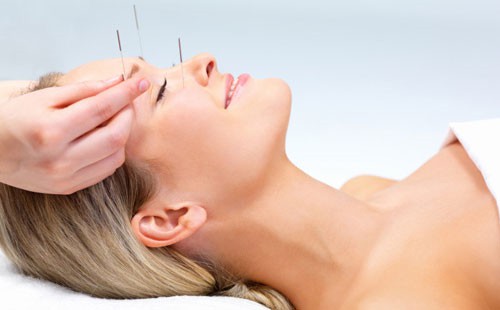 Cosmetic Acupuncture