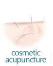 Cosmetic Acupuncture Services